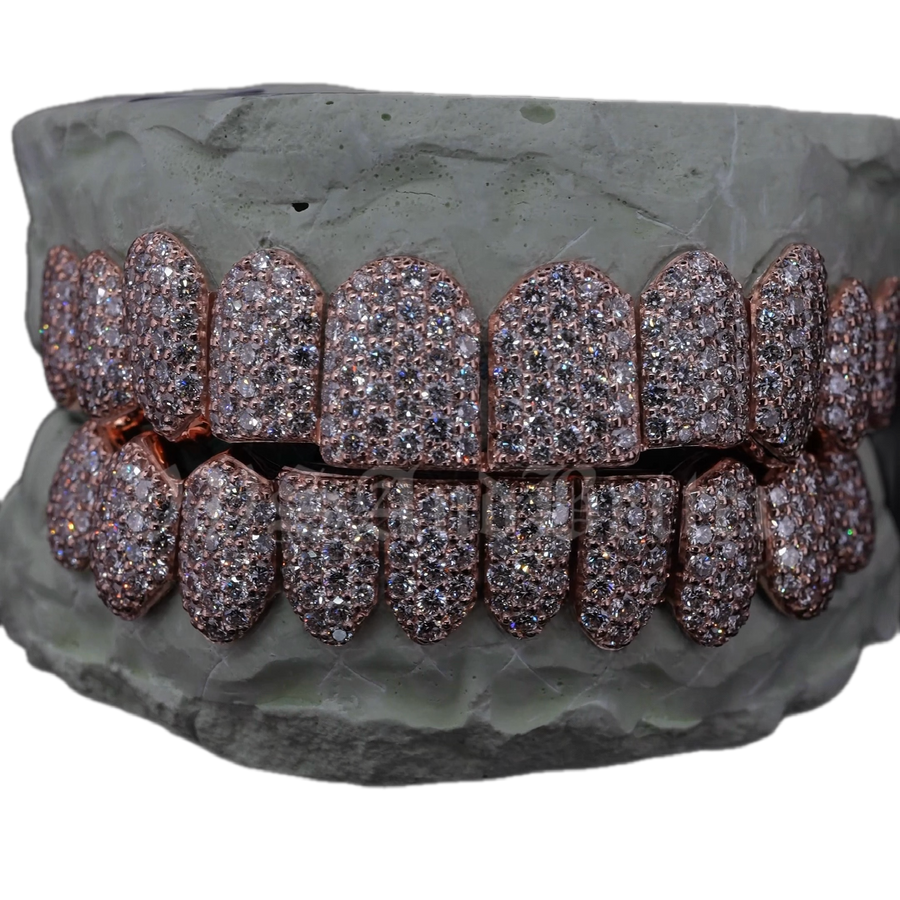 NATURAL VVS DIAMOND HONEYCOMB SET GRILLZ
