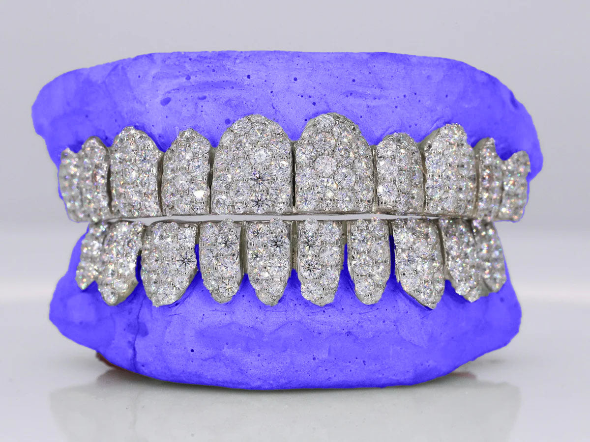 CUSTOM SIX-POINTER JUMBO CVD LAB DIAMOND GRILLZ