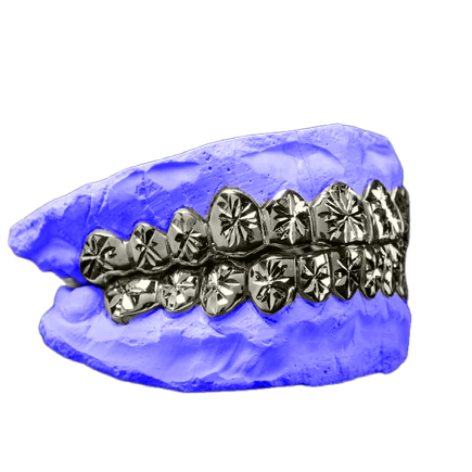 STARBURST CUT GRILLZ IN WHITE GOLD