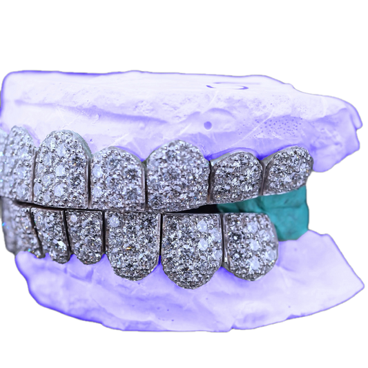 JUMBO (6 POINTER) LAB DIAMOND GRILLZ