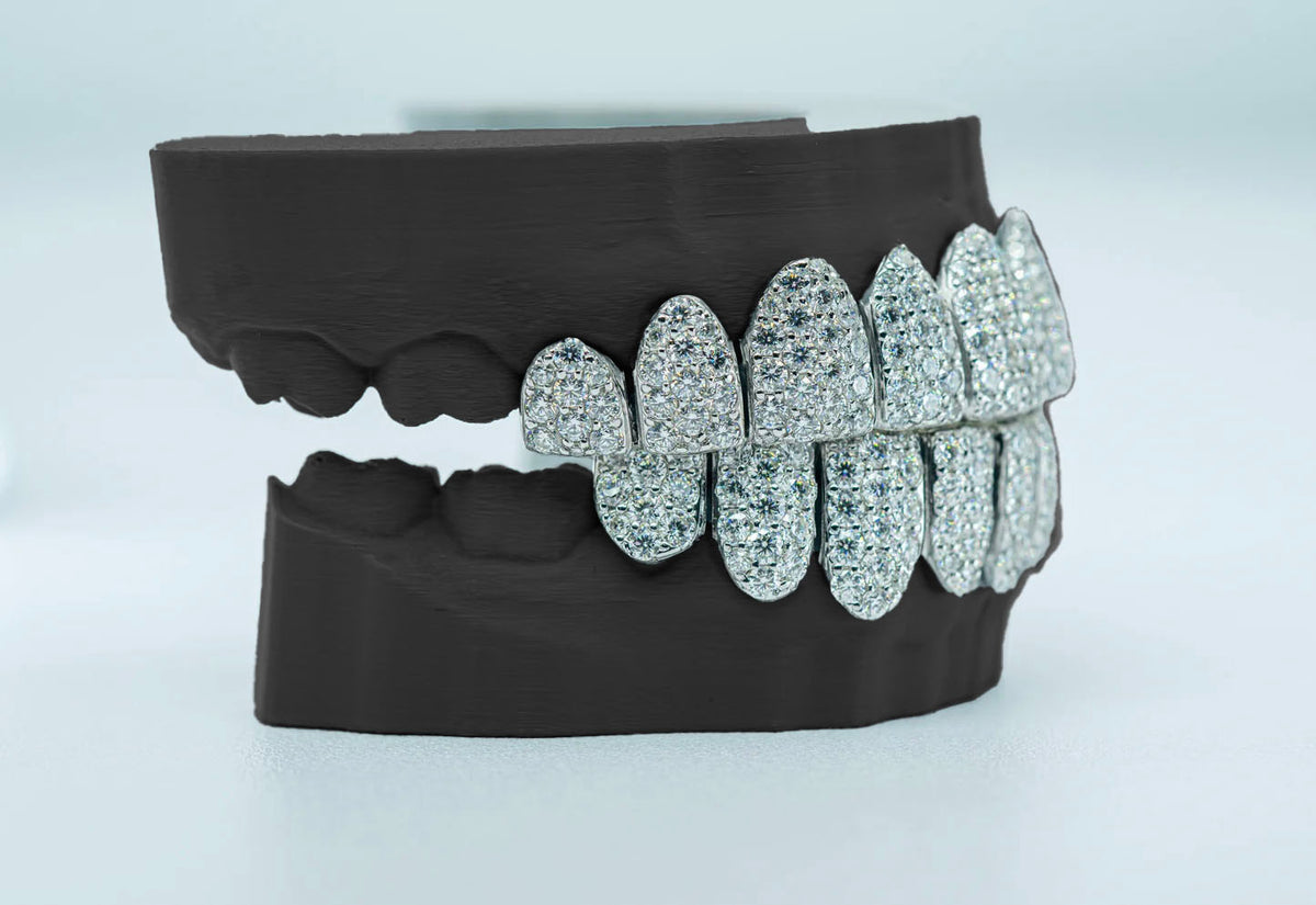 White gold jumbo natural VVS diamond grillz, side view