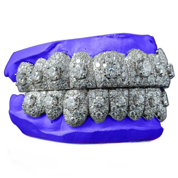 HONEYMOON VVS MOISSANITE GRILLZ