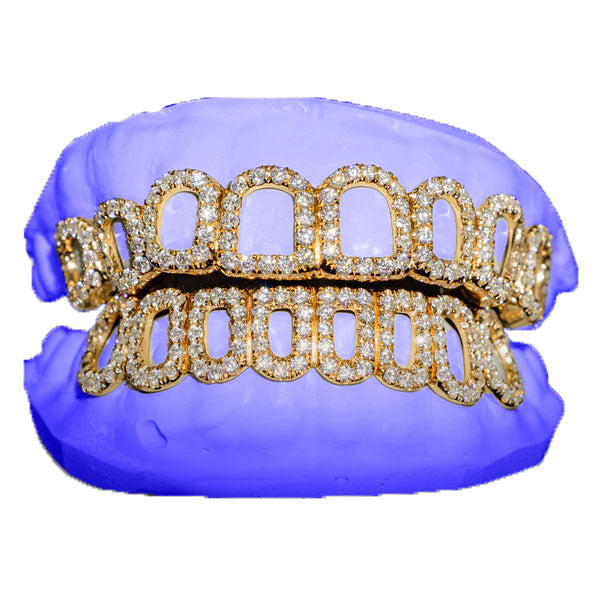 CUSTOM OPEN FACE VVS MOISSANITE GRILLZ