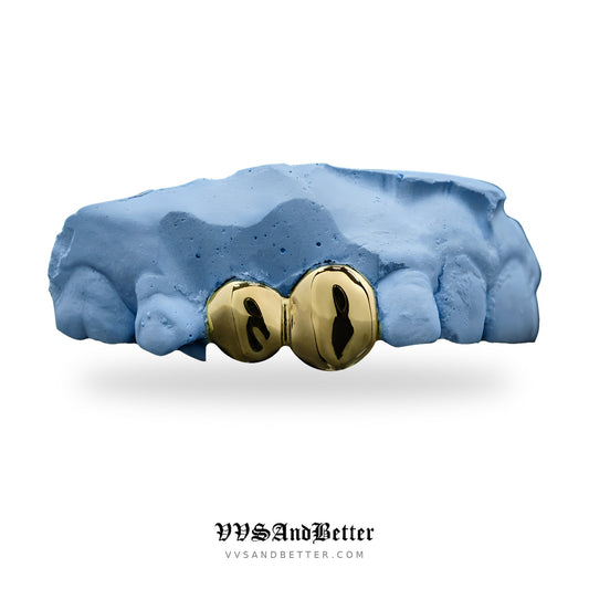 Two tooth custom gold cap grillz on a blue dental mold by VVSANDBETTER