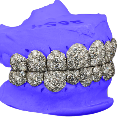 JUMBO (10 POINTER) LAB DIAMOND GRILLZ