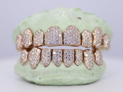 Custom VVS Clarity Moissanite Grillz