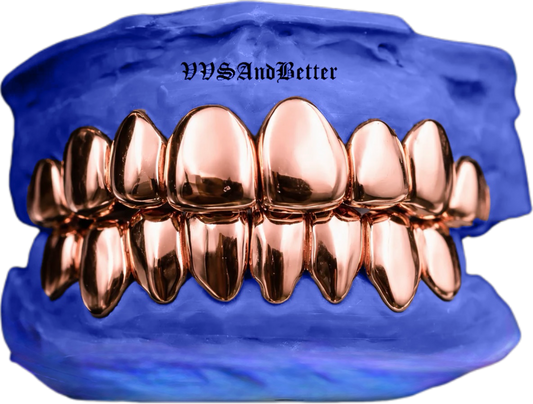 ROSE GOLD GRILLZ