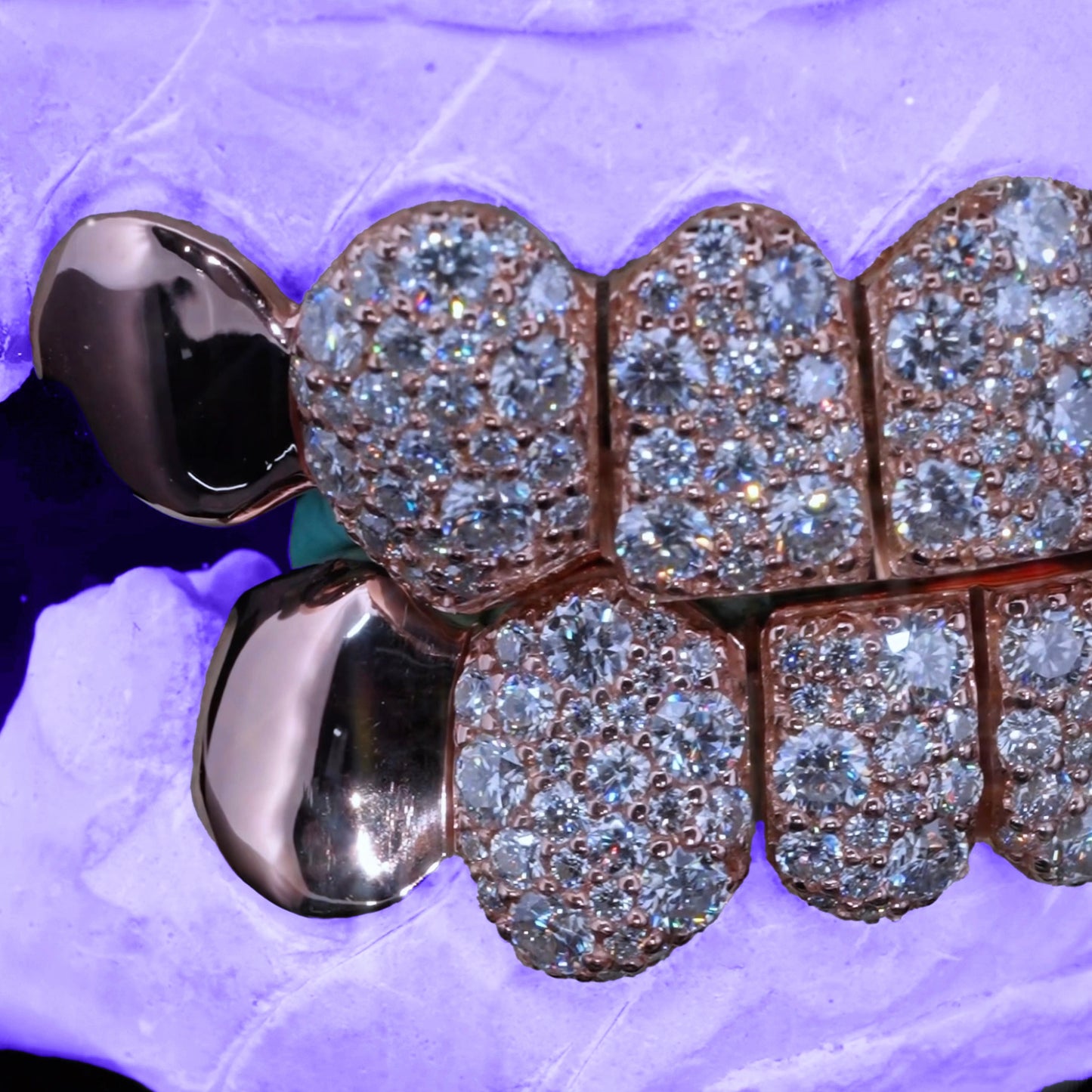 VVS MOISSANITE END CAP GALAXY SET GRILLZ (8 POINTER)