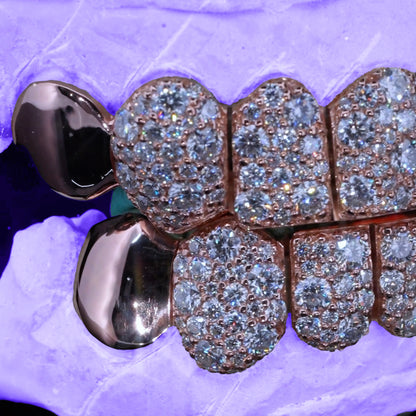 VVS MOISSANITE END CAP GALAXY SET GRILLZ (8 POINTER)