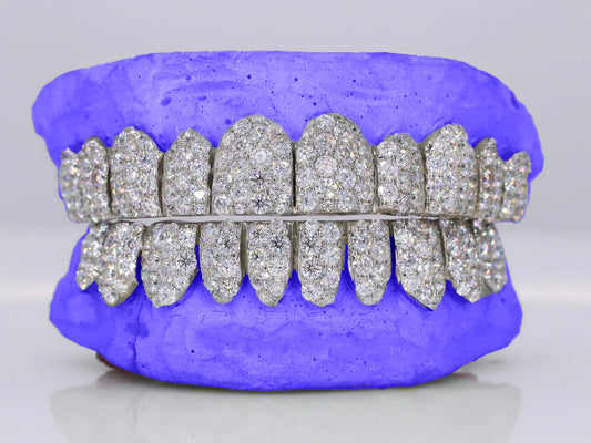 Custom Six-Pointer Jumbo Moissanite Grillz