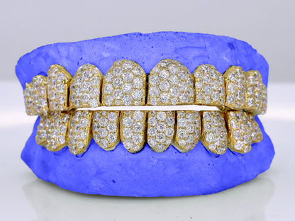 Custom Six-Pointer Jumbo Moissanite Grillz