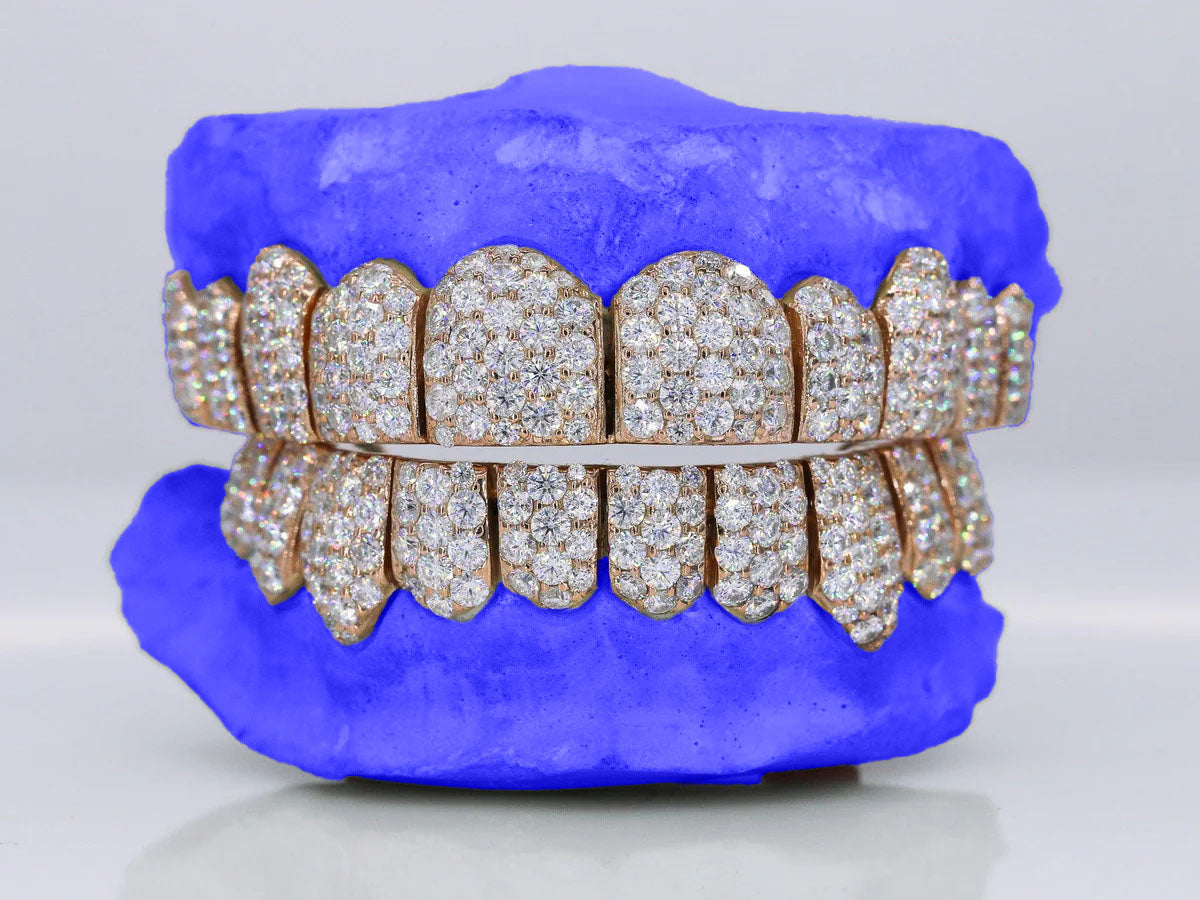 Custom Six-Pointer Jumbo Moissanite Grillz