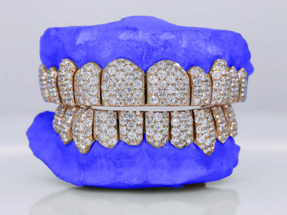 Custom Six-Pointer Jumbo Moissanite Grillz