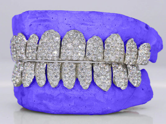 CUSTOM SIX-POINTER JUMBO CVD LAB DIAMOND GRILLZ