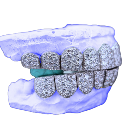 JUMBO (6 POINTER) LAB DIAMOND GRILLZ