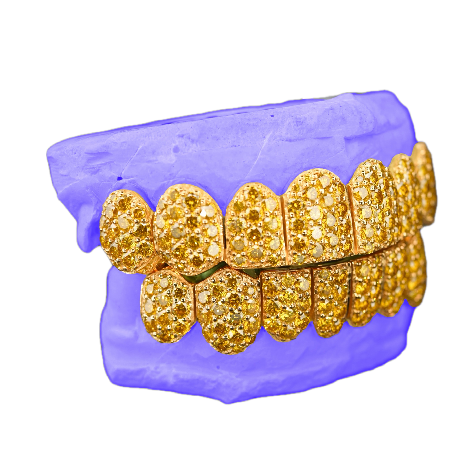 JUMBO (6 POINTER) YELLOW LAB DIAMOND GRILLZ