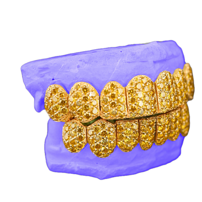 JUMBO (6 POINTER) YELLOW LAB DIAMOND GRILLZ