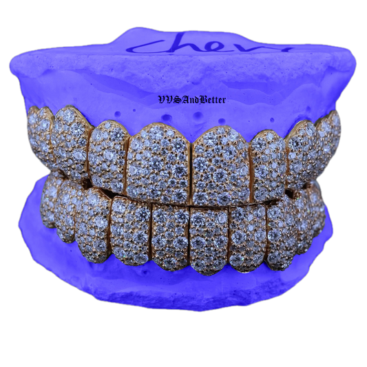 VVS MOISSANITE GALAXY SET GRILLZ (6 POINTER)