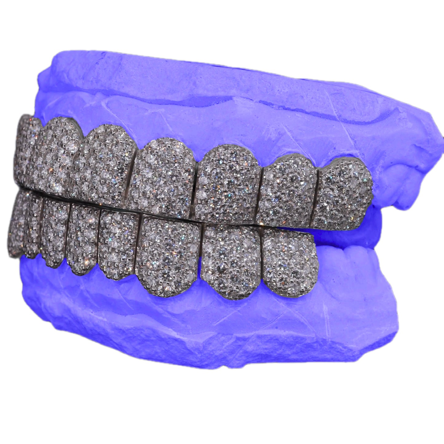 VVS LAB DIAMOND GRILLZ