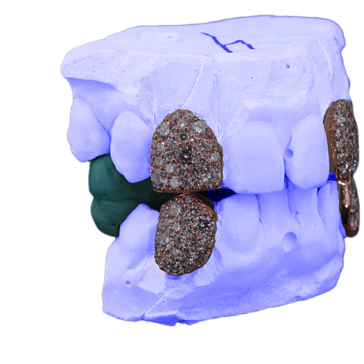 Lab diamond galaxy set fangs, side view