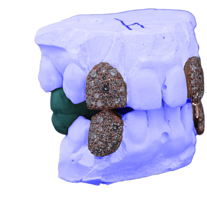 Lab diamond galaxy set fangs, side view