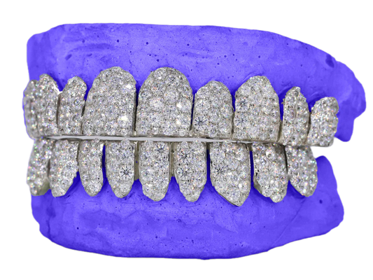 JUMBO (6 POINTER) MOISSANITE GRILLZ