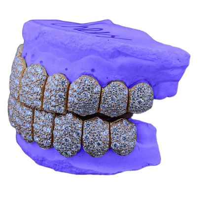VVS MOISSANITE GALAXY SET GRILLZ (6 POINTER)