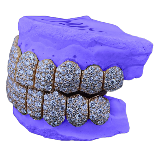 VVS MOISSANITE GALAXY SET GRILLZ (6 POINTER)