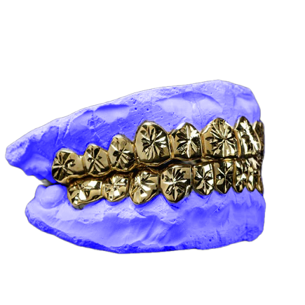 Yellow gold starburst cut grillz, angled view