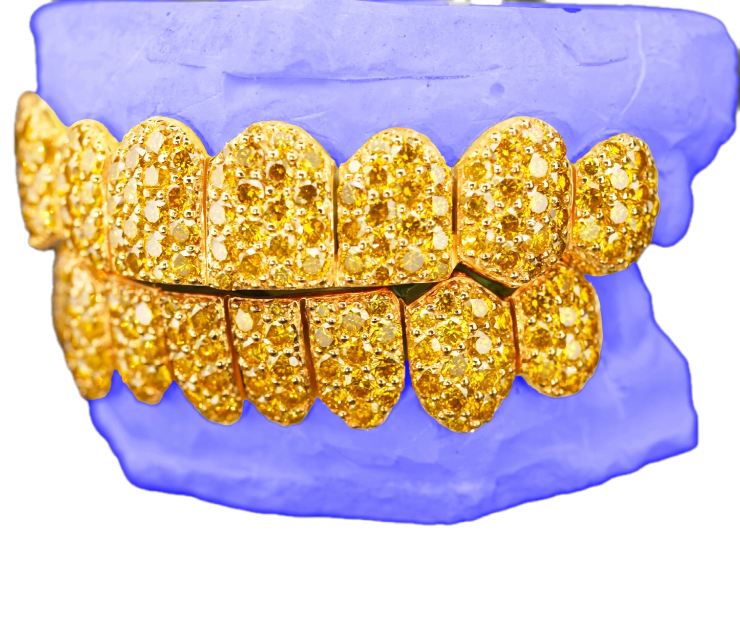 JUMBO (6 POINTER) YELLOW LAB DIAMOND GRILLZ