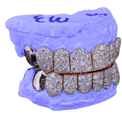 VVS MOISSANITE END CAP GALAXY SET GRILLZ (8 POINTER)