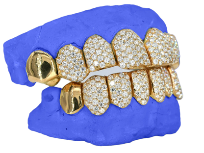 VVS MOISSANITE END CAP GRILLZ