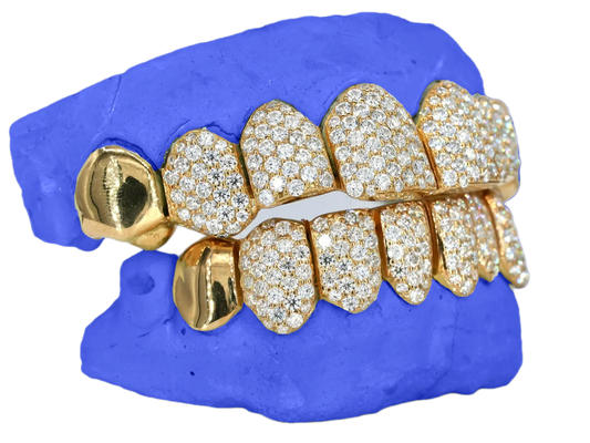 VVS MOISSANITE END CAP GRILLZ