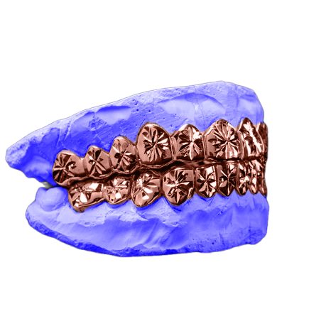 STARBURST CUT GRILLZ IN ROSE GOLD