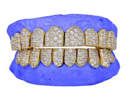 JUMBO (6 POINTER) LAB DIAMOND GRILLZ