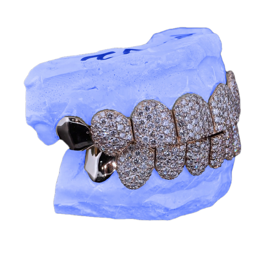 VVS LAB DIAMOND END CAP GRILLZ