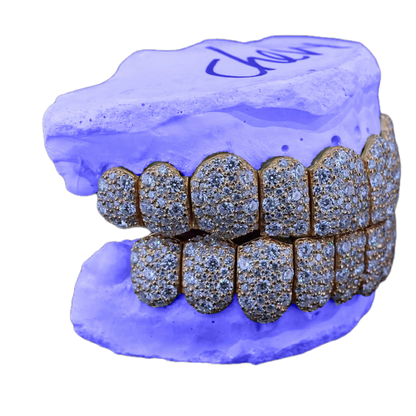 VVS MOISSANITE GALAXY SET GRILLZ (6 POINTER)