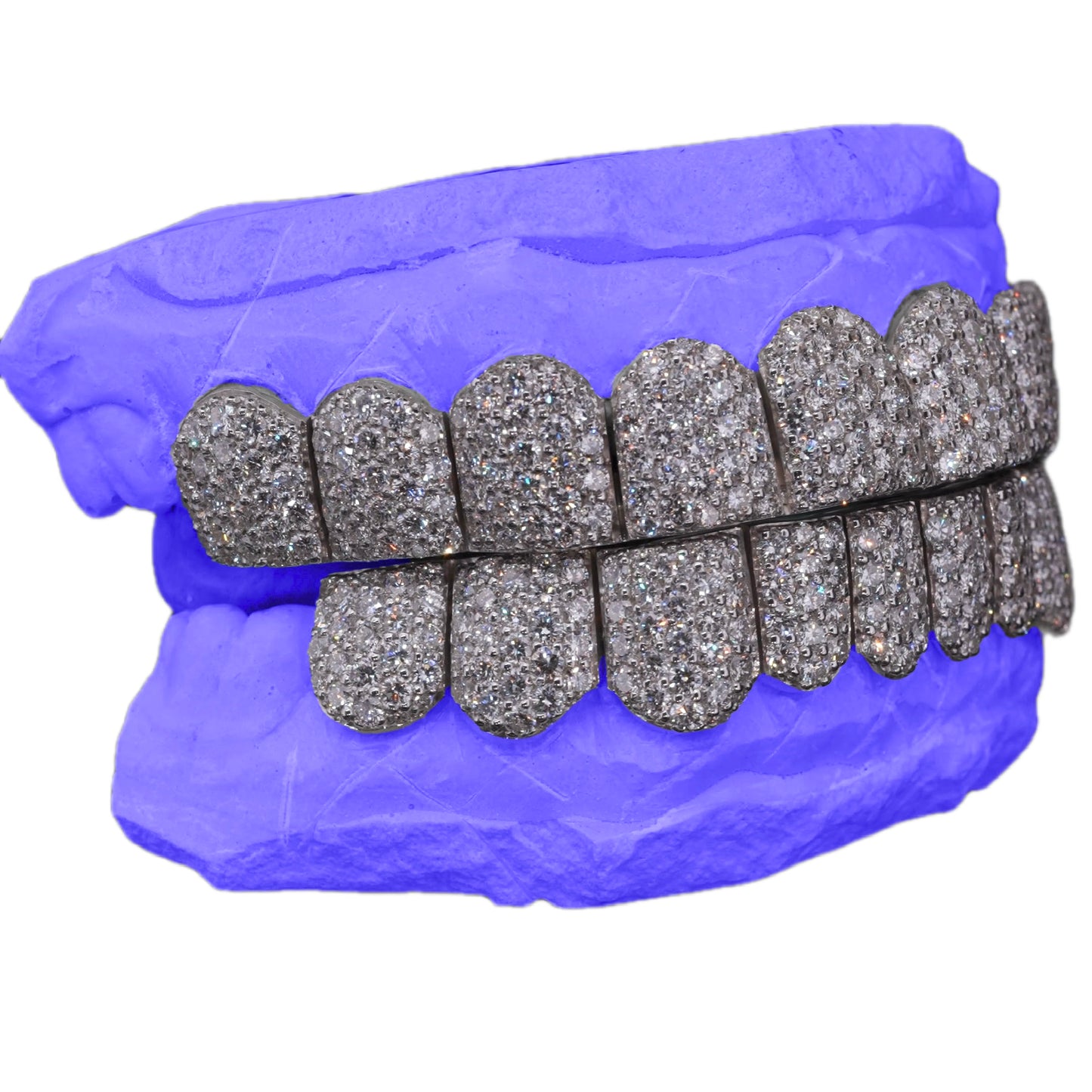 VVS LAB DIAMOND GRILLZ