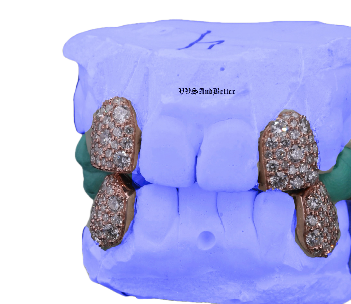 8 pointer lab diamond galaxy set fang grillz in solid gold