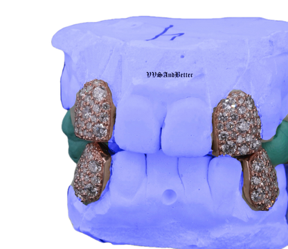 8 pointer lab diamond galaxy set fang grillz in solid gold