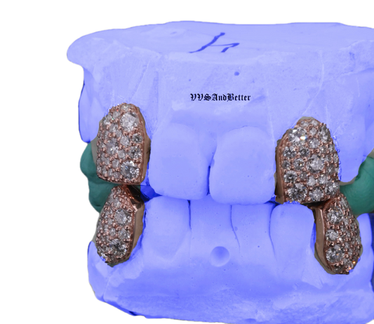 LAB DIAMOND GALAXY SET (8 POINTER) FANGS