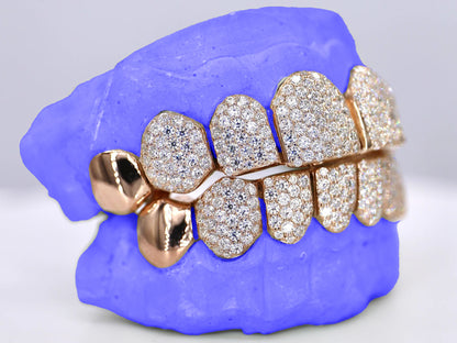 Moissanite End Cap Grillz