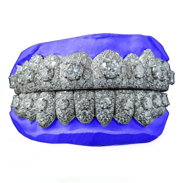 HONEYMOON CUSTOM GRILLZ