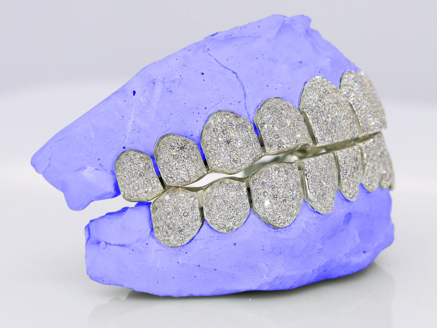 VVS CLARITY LAB DIAMOND GRILLZ (CVD)