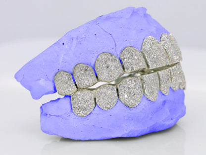 VVS CLARITY LAB DIAMOND GRILLZ (CVD)