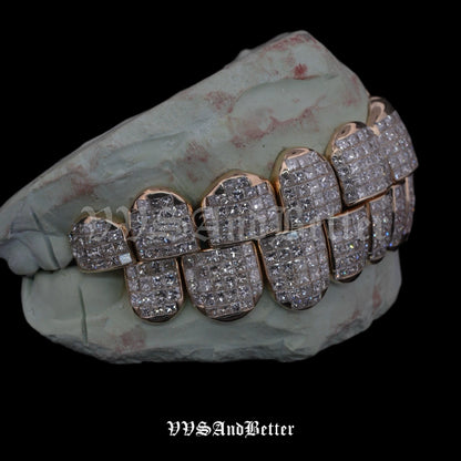 Hand-set natural diamond invisible set grillz, right side view