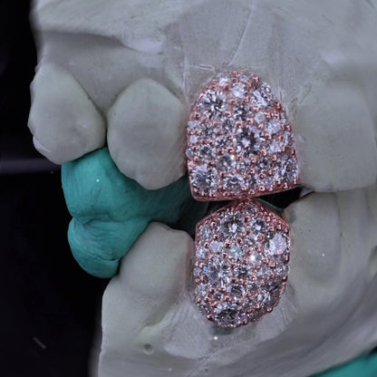 LAB DIAMOND GALAXY SET (8 POINTER) FANGS