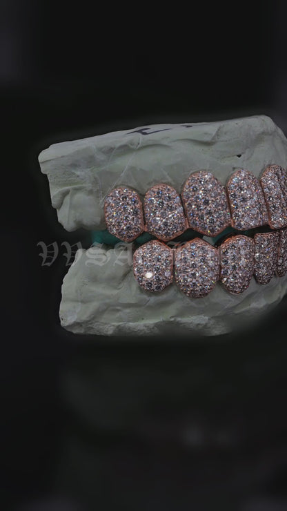 Natural VVS diamond honeycomb set grillz in 14K gold by VVSANDBETTER, 2 pointer 1.7 mm stones